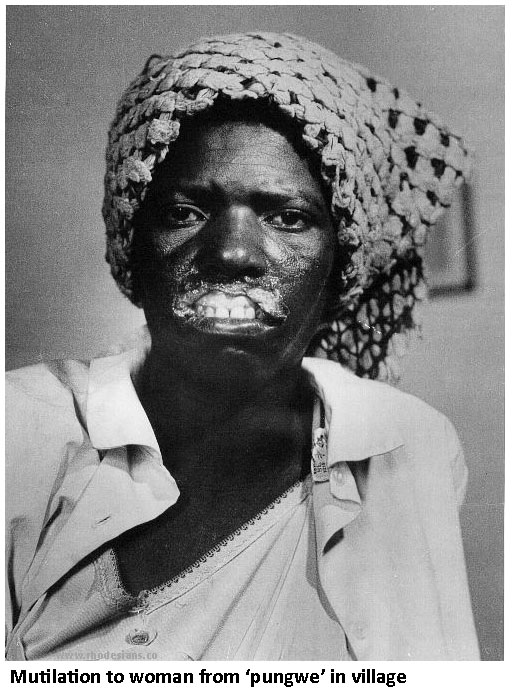 African woman with mutilated lips froma pungwe held by ZANLA terrorists during the Rhodesian Bush War